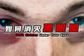 不想被贴“渣”的标签？教你识别黑眼圈类型，三步重获清白人生视频封面