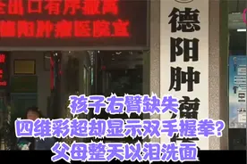 孩子右臂缺失，四维彩超却显示双手握拳？父母整天以泪洗面视频封面