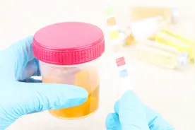 血糖不高，但尿糖高是怎么回事？医生说出这个根源！
