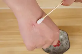 蚊子叮咬起包红肿，教你两个好方法，止痒消肿，特别适合小朋友视频封面