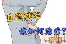 得了椎管狭窄，腰腿疼痛影响生活！该如何治疗？医生告知3个原则视频封面