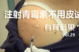 如果注射青霉素时不用皮试，后果会有多严重？视频封面