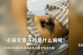 罕见！花季女孩染“怪病”后腰长出浓密毛发