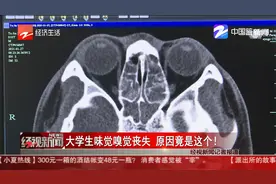 大学生味觉嗅觉丧失 原因竟是这个！视频封面