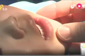 1岁幼儿误食502胶水，好在家长第一时间这样处理，才没发生危险