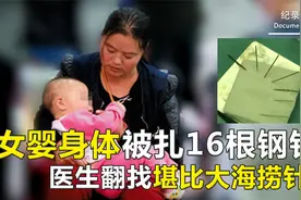 女宝宝身体被扎16根钢针！取针时，医生翻找五脏六腑堪比大海捞针视频封面