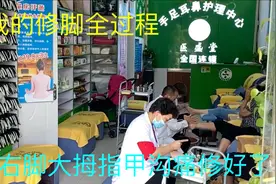 老头行修脚按摩全过程，右脚大拇指甲沟痛修完不疼了，脚好去旅游视频封面