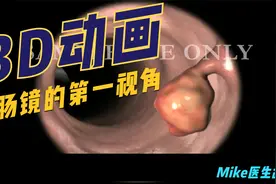 【3D医学动画】跟着第一视角带你看看肠镜是如何做的