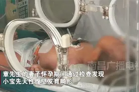 先天没肚皮，肠子外露，畸形男婴接受修补手术视频封面
