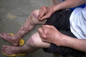 不喝酒不抽烟也容易得癌症？原来问题出在这，要提前了解！视频封面