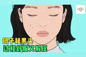 镊子拔黑头，整个鼻子的黑头一次处理干净，过程实在是舒服又解压视频封面