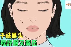 镊子拔黑头，整个鼻子的黑头一次处理干净，过程实在是舒服又解压视频封面
