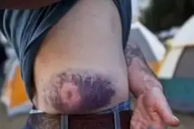 警察用的橡胶子弹，威力真的那么小？被击中后伤口看着就疼