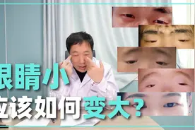 眼睛太小了想变大，应该怎么办？视频封面