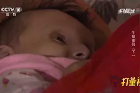 河南一男孩未老先衰疑患儿童早衰症，究竟是何导致的？视频封面