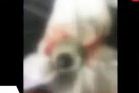 没救！26岁小伙醉酒摔倒,起来后左眼球掉落!几小时后家人捡回来了视频封面