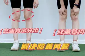 脂肪性大腿改造计划，改善膝盖内侧突出+膝盖赘肉，零强度快速练视频封面
