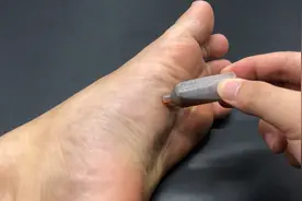 睡前在脚底涂点藿香正气水，搞定了男女人的难题，早点清楚就好了