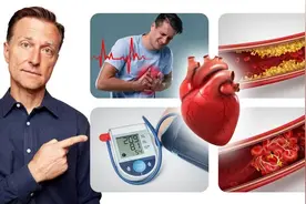 心臟10種狀況,最好自然療法,柏格醫生 Dr Berg
 2022年7月1日视频封面