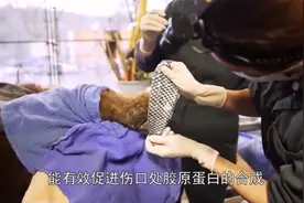 真实存在的“人型美人鱼”，一个意外，致使他们在身体上植入鱼皮视频封面