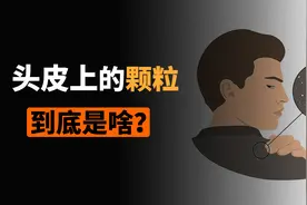 头皮上抠下来的小颗粒，到底是啥？视频封面