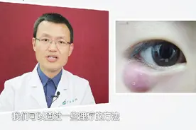 眼睑发红、充血、肿胀等病变，多是麦粒肿的表现视频封面