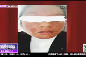 假药？医生推荐用医院自制甘草油，致女子险被毁容，讨要说法未果视频封面