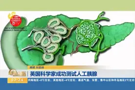 英国科学家成功测试人工胰腺，2型糖尿病患者或可得到更好的治疗视频封面