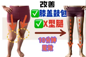 膝盖鼓包，弯曲变形？10分钟，腿又细长、又笔直了视频封面