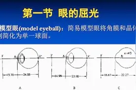 屈光不正有什么症状，主任医师来为您解答，讲的很详细视频封面
