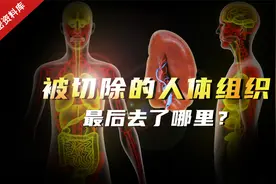 医院切除的人体组织和器官，最后都去了哪里？患者可以带走吗？