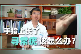 手指上长了寻常疣应该如何治疗？皮肤科医生为你解答视频封面