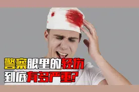 警察眼里的轻伤有多严重? 为何我们认为的重伤，在法律上只算轻伤视频封面