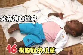 非洲纪录片，男孩出生就16根脚趾，父亲殴打虐待母亲，认为不详视频封面