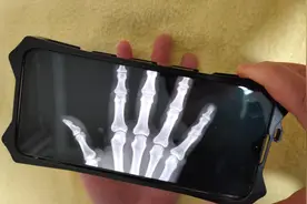 教你打开手机“透视”功能，连手上的骨头都能看清楚，太厉害了视频封面