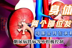身体两个部位发臭要注意！可能是肾在求救？怎么预防尿毒症？视频封面