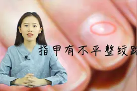指甲上出现纹路代表什么？别担心，了解纹路产生原因，对症调理视频封面