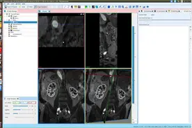 SimVascular Tutorial 2 Creating centerline paths