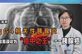 特殊病例：最容易误诊为“胰腺癌”的疾病，一旦发现即晚期！视频封面