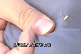 棉服剐蹭如何修补？黏上口香糖如何清理？小妙招教你轻松解决！视频封面