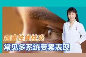 眼睛反复发红、充血、疼痛，可不一定是眼病，当心强直性脊柱炎！视频封面