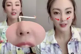 张雨绮近照曝光疑似变脸，鼻子一高一低不对称，疑似整容后遗症视频封面