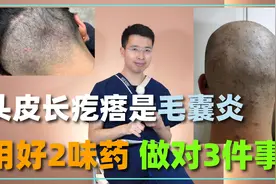 头皮上长疙瘩，那是毛囊炎！做对3件事，用好3味药，消炎好得快