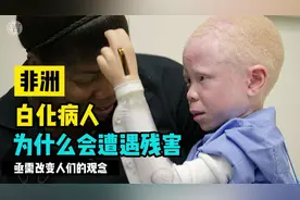 非洲白化病人，为什么会被残害？真正的使命是要改变人们的观念视频封面