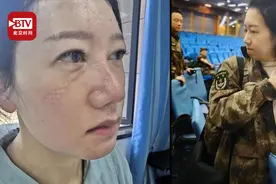 女医生驰援武汉前后对比照 她们摘下口罩后的面容让人心疼视频封面