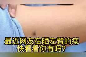 最近网友在晒左臂的痣，快看看为什么？视频封面