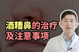 得了酒糟鼻，鼻头又大又红还能治好吗？医生给了6点建议视频封面