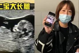 B超看到孩子的轮廓，像侯哥，还是大长腿，但是咋看也不像女孩儿视频封面