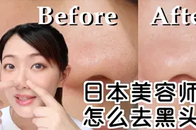 6分钟告别草莓鼻日本美容师教你正确祛黑头视频封面