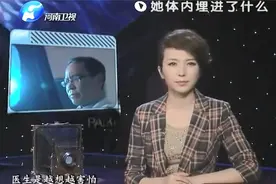 24岁女子体内有吸引力，X光震惊医生，取出异物全是弹簧视频封面